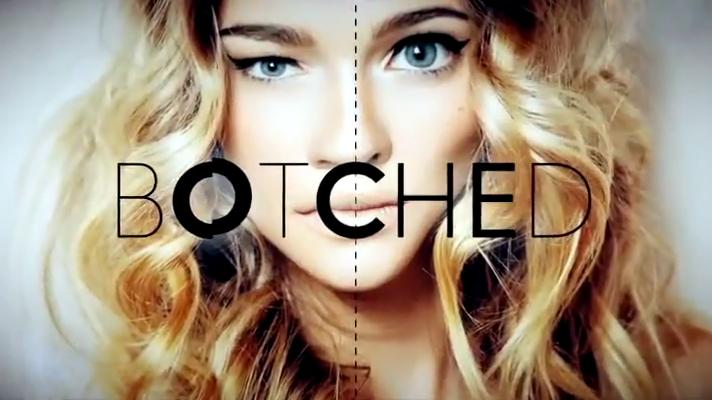  Изуродованные тела [Сезон 5. Серия 2. (Botched. S05E02) 2019]